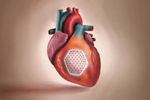 Adesivo muscular feito de células-tronco pode tratar insuficiência cardíaca Adesivo muscular feito de células-tronco pode tratar insuficiência cardíaca