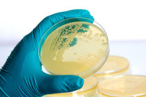 Antibi&oacute;tico inteligente pode matar bact&eacute;rias mortais enquanto poupa o microbioma