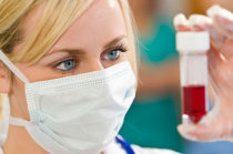 CD44 ajuda a monitorizar resposta &agrave; quimioterapia em pacientes com c&acirc;ncer gastrointestinal