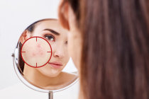 Contraceptivos hormonais e acne: uma an&aacute;lise sobre o efeito antiacne dos diferentes anticoncepcionais hormonais