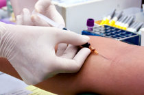 Controle glic&ecirc;mico na diabetes tipo 1 e risco de eventos cardiovasculares ou morte depois de revasculariza&ccedil;&atilde;o do mioc&aacute;rdio