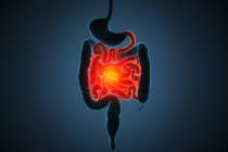 Descoberta uma das principais causas da doen&ccedil;a inflamat&oacute;ria intestinal