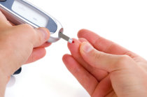 Diabetes pode aumentar risco de c&acirc;ncer de es&ocirc;fago em pessoas com es&ocirc;fago de Barrett, apresentado em confer&ecirc;ncia do <i>American College of Gastroenterology</i>