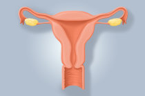 Estuda observa maior risco de acidente vascular cerebral em mulheres que realizaram histerectomia e/ou remoção de ovários Estuda observa maior risco de acidente vascular cerebral em mulheres que realizaram histerectomia e/ou remoção de ovários