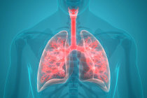 Estudo descobre tr&ecirc;s novas maneiras seguras e eficazes de tratar tuberculose resistente a medicamentos