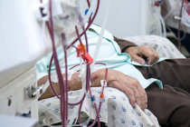 Eventos cardiovasculares aumentam o risco de insufici&ecirc;ncia renal com terapia renal substitutiva