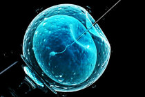 Fertiliza&ccedil;&atilde;o <i>in vitro</i> usando DNA de tr&ecirc;s pessoas evitou que os beb&ecirc;s nascidos herdassem doen&ccedil;as gen&eacute;ticas graves