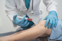 Inje&ccedil;&otilde;es intra-articulares de &aacute;cido hialur&ocirc;nico n&atilde;o ajudam a osteoartrite do joelho mais do que placebo