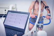 Novo inibidor da miosina card&iacute;aca melhora a capacidade de exerc&iacute;cio na cardiomiopatia hipertr&oacute;fica