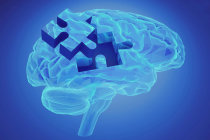 Papel importante do v&iacute;rus herpes simplex tipo 1 na doen&ccedil;a de Alzheimer, revis&atilde;o publicada pela revista <i>Frontier Aging Neuroscience</i>