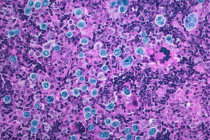 Pesquisadores criam nova mol&eacute;cula capaz de ativar as vias de morte celular em c&eacute;lulas cancer&iacute;genas