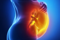 Primeiro tratamento pr&eacute;-natal para atrofia muscular espinhal mostra-se promissor