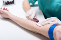 Prostasina, uma prote&iacute;na do sangue, pode ajudar a prever diabetes e morte por c&acirc;ncer