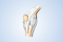 Quanto maior o consumo de leite, menor a progress&atilde;o da osteoartrite de joelho em mulheres, segundo artigo do <i>Arthritis Care & Research</i>