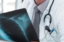 Sulfato de magn&eacute;sio intravenoso ou em nebuliza&ccedil;&atilde;o pode n&atilde;o ajudar muito no tratamento da asma aguda grave: estudo randomizado, publicado pelo <i>The Lancet Respiratory Medicine</i>