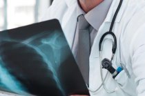 Terap&ecirc;utica tripla no tratamento da doen&ccedil;a pulmonar obstrutiva cr&ocirc;nica reduz exacerba&ccedil;&otilde;es dos sintomas