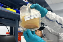 Terapia que transforma gânglios linfáticos em fígados passa pelo primeiro ensaio clínico em humanos Terapia que transforma gânglios linfáticos em fígados passa pelo primeiro ensaio clínico em humanos