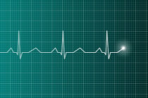 Variantes gen&eacute;ticas raras associadas &agrave; morte card&iacute;aca s&uacute;bita em adultos, publicado pelo <i>Journal of the American College of Cardiology</i>