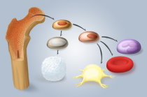 Leucemia mieloide cr&ocirc;nica
