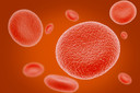 NEJM: uso de transfus&otilde;es de sangue regulares na preven&ccedil;&atilde;o de infartos cerebrais em crian&ccedil;as com anemia falciforme