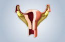 A endometriose poderia ser controlada com inje&ccedil;&otilde;es mensais de anticorpos