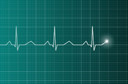 A sobrecarga atrial esquerda ajuda a prever a fibrila&ccedil;&atilde;o atrial em pacientes com insufici&ecirc;ncia card&iacute;aca