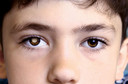 Apoio ao paciente: campanha de diagn&oacute;stico precoce de Retinoblastoma