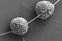 C&eacute;lulas cancerosas usam nanotubos para chegar &agrave;s c&eacute;lulas imunol&oacute;gicas pr&oacute;ximas e capturar suas mitoc&ocirc;ndrias geradoras de energia
