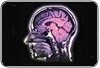 Estimula��o el�trica cerebral pode melhorar o desempenho em testes de mem�ria