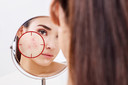 Contraceptivos hormonais e acne: uma an&aacute;lise sobre o efeito antiacne dos diferentes anticoncepcionais hormonais
