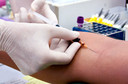 Controle glic&ecirc;mico na diabetes tipo 1 e risco de eventos cardiovasculares ou morte depois de revasculariza&ccedil;&atilde;o do mioc&aacute;rdio