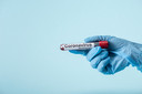 DETECTR: uma nova forma de detec&ccedil;&atilde;o r&aacute;pida, sens&iacute;vel e espec&iacute;fica do novo coronav&iacute;rus SARS-CoV-2 baseada em CRISPR
