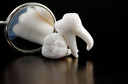 Estudo sugere caminho conectando doen&ccedil;a periodontal com artrite reumatoide