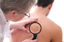 Identificado alvo potencial para nova abordagem do tratamento do melanoma, segundo pesquisadores do National Cancer Institute
