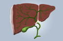 Incid&ecirc;ncia de carcinoma hepatocelular em pacientes com cirrose associada ao v&iacute;rus da hepatite C tratada com agentes antivirais de a&ccedil;&atilde;o direta