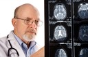 Infartos cerebrais silenciosos impactam na fun&ccedil;&atilde;o cognitiva em pacientes com fibrila&ccedil;&atilde;o atrial