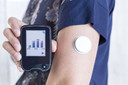 Monitoramento instant&acirc;neo da glicose no diabetes tipo 1 ou 2 diminui taxa de complica&ccedil;&otilde;es agudas do diabetes
