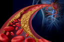 Nova diretriz ACC/AHA 2026 sobre dislipidemia: o que mudou e o que voc&ecirc; precisa saber