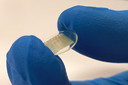 Nova terapia pode ajudar a combater o c&acirc;ncer de pele utilizando microagulhas dissol&uacute;veis para entregar f&aacute;rmacos diretamente ao tumor, via terapia fotodin&acirc;mica