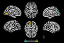 O SARS-CoV-2 infecta astr&oacute;citos cerebrais de pacientes com COVID-19 e prejudica a viabilidade neuronal
