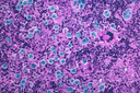 Pesquisadores criam nova mol&eacute;cula capaz de ativar as vias de morte celular em c&eacute;lulas cancer&iacute;genas