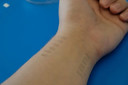 Tatuagens tempor&aacute;rias de grafeno podem monitorar continuamente a press&atilde;o arterial