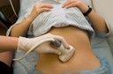 &Eacute; poss&iacute;vel acompanhar com ultrassonografias massas ovarianas com morfologia benigna, segundo estudo publicado pelo The Lancet Oncology